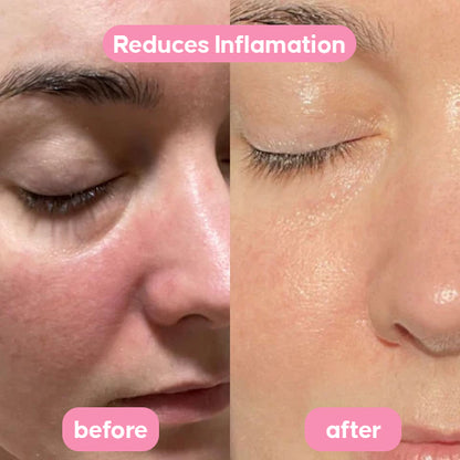 PDRN Pink Collagen Gel Toner Pads