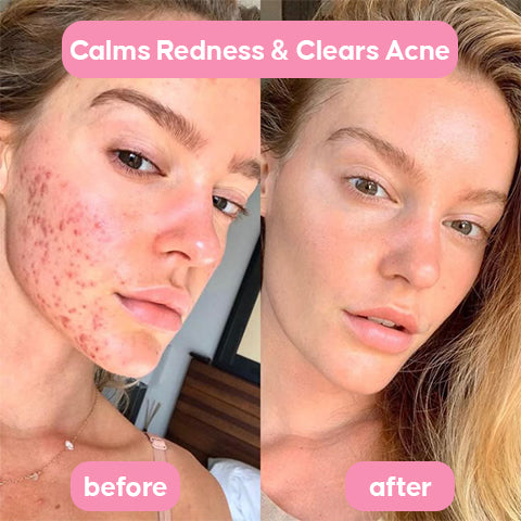 PDRN Pink Collagen Gel Toner Pads